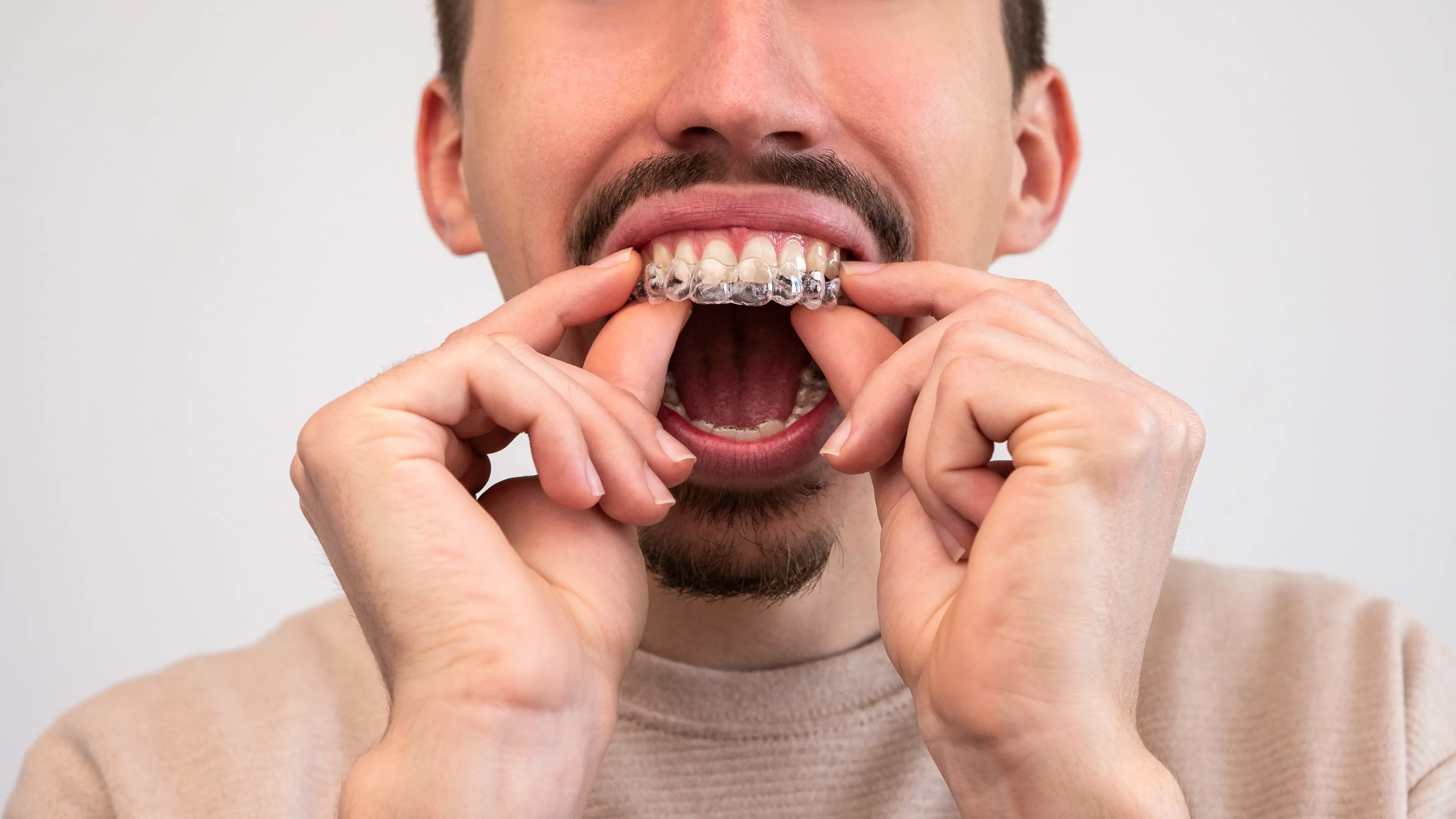 Does Invisalign Really Fix Bad Teeth