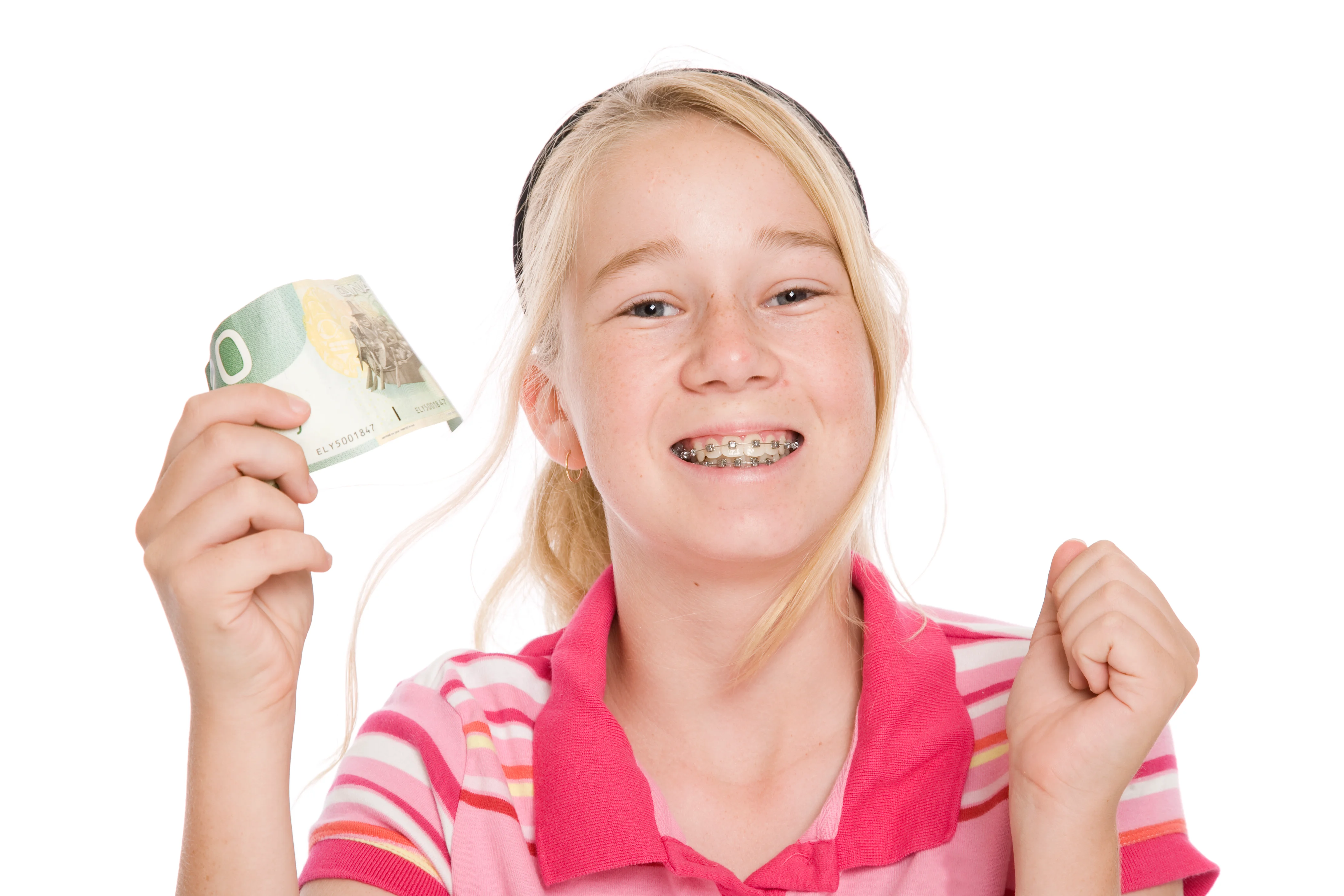 What is the Lowest You Can Pay for Braces
